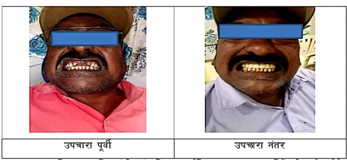 दंत उपचार